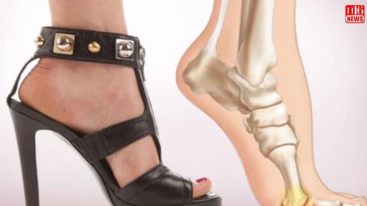 Did You Know High Heels Can Make You Prone To Ankle Injuries?